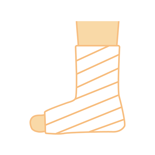 足にギブスのイラスト