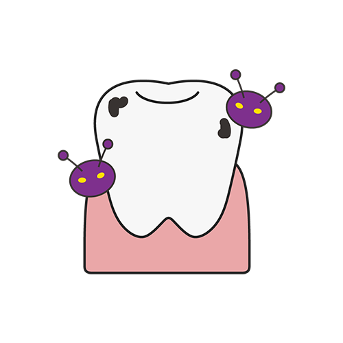 虫歯になった歯のイラスト