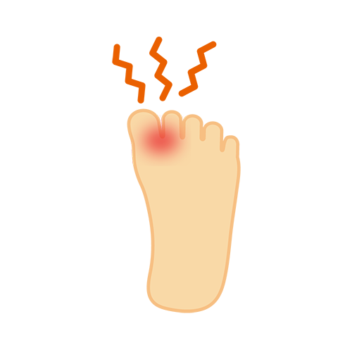 水虫が気になるイラストのイラスト